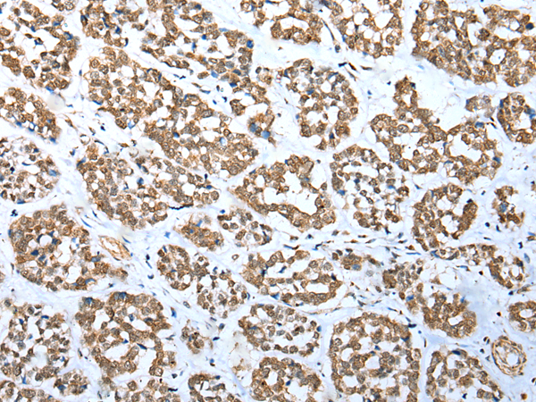 Rabbit Polyclonal Antibody to DTWD1