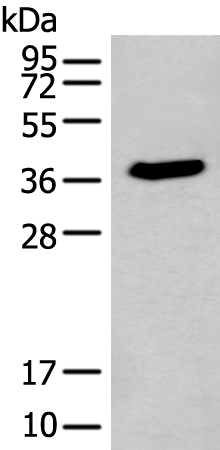 Rabbit Polyclonal Antibody to ACBD4