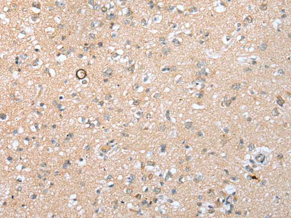 Rabbit Polyclonal Antibody to BBS9