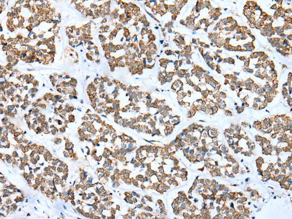 Rabbit Polyclonal Antibody to FSD1L