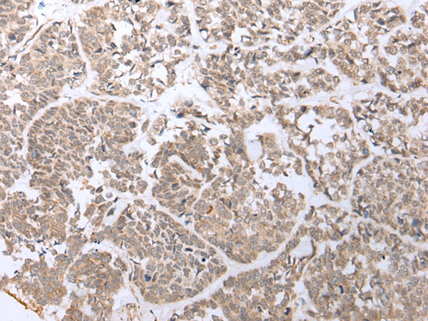 Rabbit Polyclonal Antibody to PHTF2