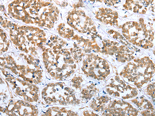 Rabbit Polyclonal Antibody to ERMP1