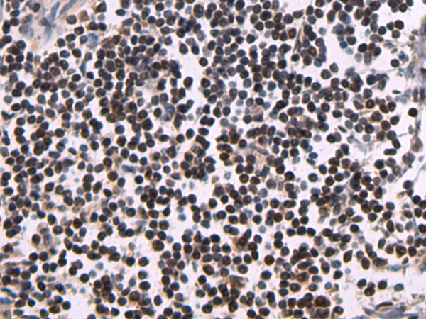 Rabbit Polyclonal Antibody to ATXN7L3