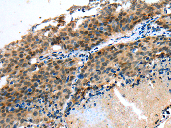 Rabbit Polyclonal Antibody to MYBPHL
