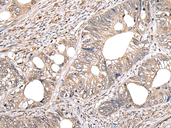 Rabbit Polyclonal Antibody to GCNT2