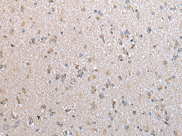 Rabbit Polyclonal Antibody to B4GALT5