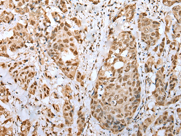 Rabbit Polyclonal Antibody to ZNF486