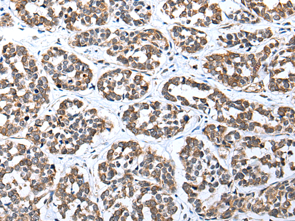 Rabbit Polyclonal Antibody to LRRC19