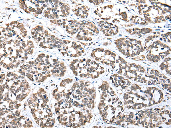 Rabbit Polyclonal Antibody to UBXN2B