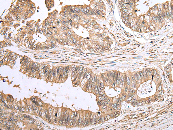 Rabbit Polyclonal Antibody to CASP5