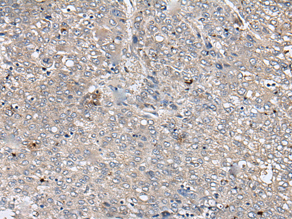 Rabbit Polyclonal Antibody to RUFY4