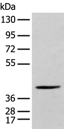 Rabbit Polyclonal Antibody to POMK