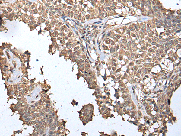 Rabbit Polyclonal Antibody to METAP1D