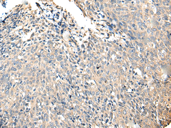 Rabbit Polyclonal Antibody to SLC35E2A