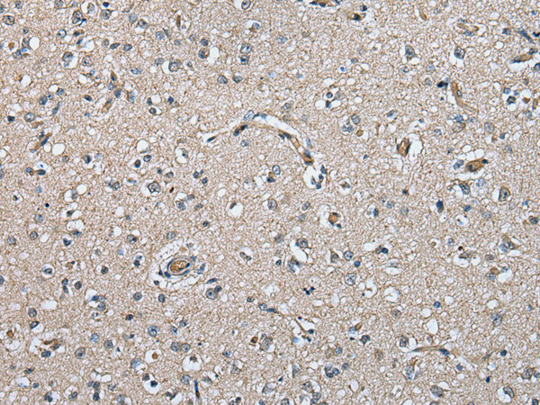 Rabbit Polyclonal Antibody to PRSS38