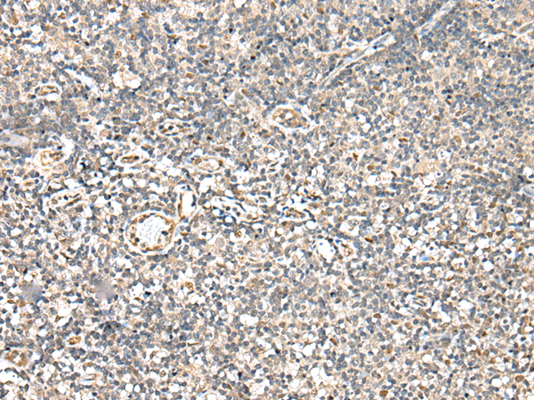 Rabbit Polyclonal Antibody to KAZN