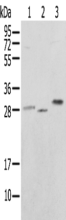 Rabbit Polyclonal Antibody to UBE2J2