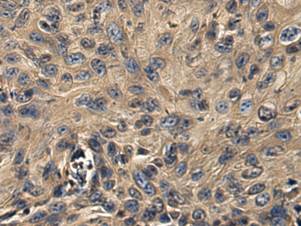 Rabbit Polyclonal Antibody to IFNW1