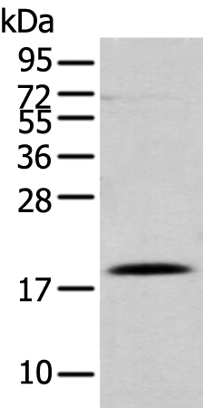 Rabbit Polyclonal Antibody to DAND5