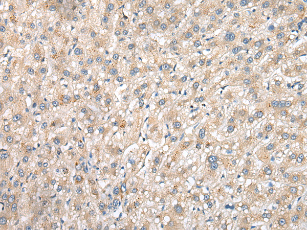 Rabbit Polyclonal Antibody to OIT3