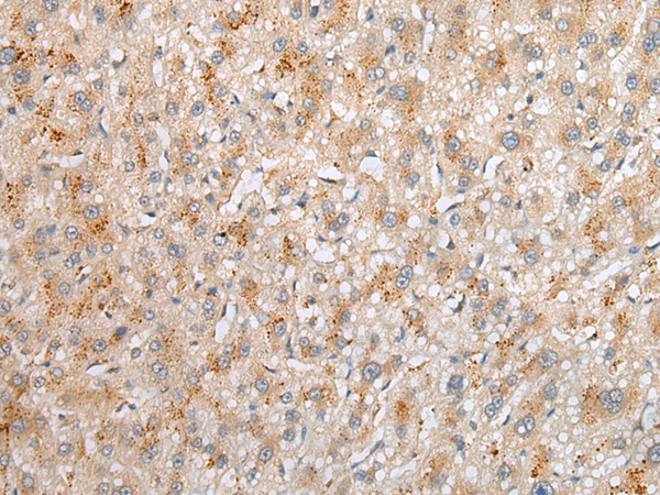 Rabbit Polyclonal Antibody to THEM5
