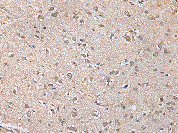 Rabbit Polyclonal Antibody to PIN4