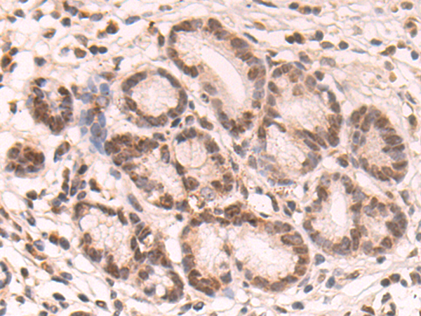 Rabbit Polyclonal Antibody to COMMD6