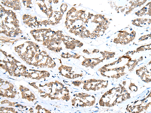 Rabbit Polyclonal Antibody to ZNRD1