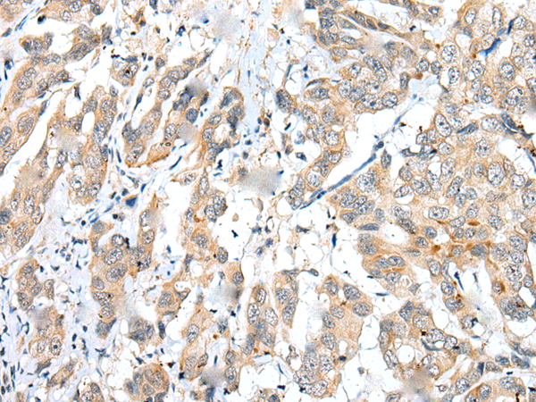 Rabbit Polyclonal Antibody to FUOM