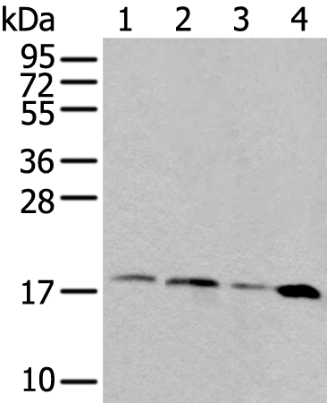 Rabbit Polyclonal Antibody to RPS15