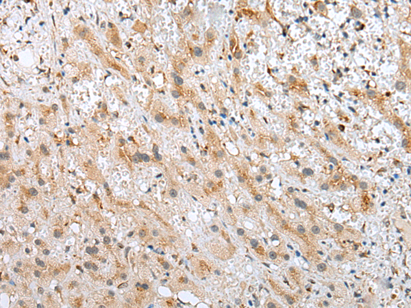 Rabbit Polyclonal Antibody to SYCE3