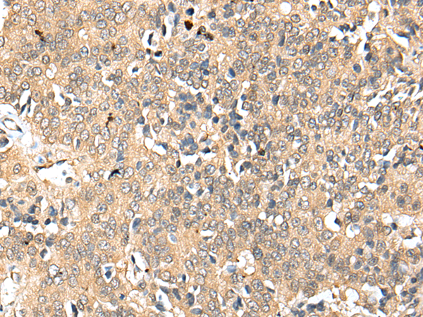 Rabbit Polyclonal Antibody to C4orf46