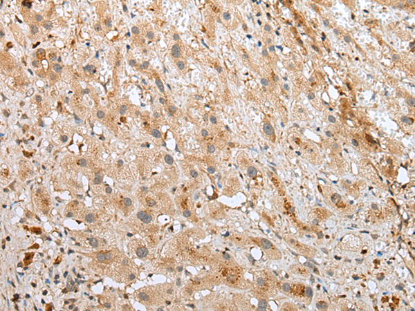 Rabbit Polyclonal Antibody to SPACA3