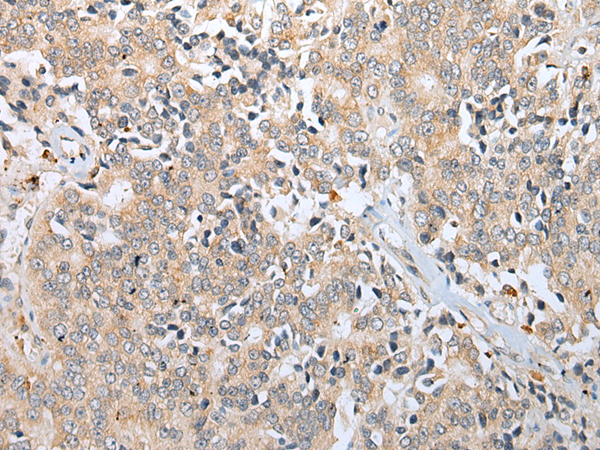 Rabbit Polyclonal Antibody to RFLNA