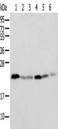 Rabbit Polyclonal Antibody to SPCS2