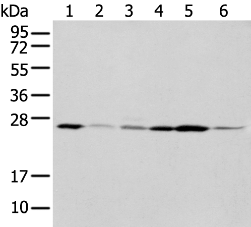 Rabbit Polyclonal Antibody to NUDT21