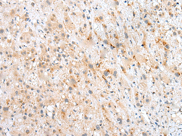 Rabbit Polyclonal Antibody to NUDT22