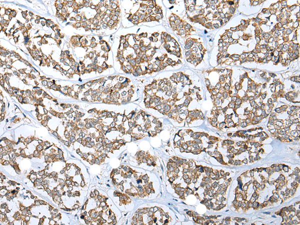 Rabbit Polyclonal Antibody to NUDT18