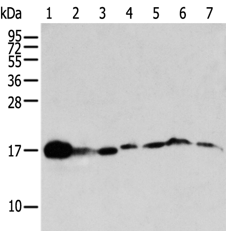 Rabbit Polyclonal Antibody to NUDT2