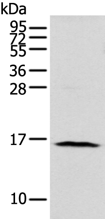Rabbit Polyclonal Antibody to NUDT10