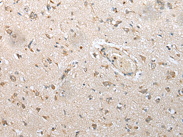 Rabbit Polyclonal Antibody to NUDT14