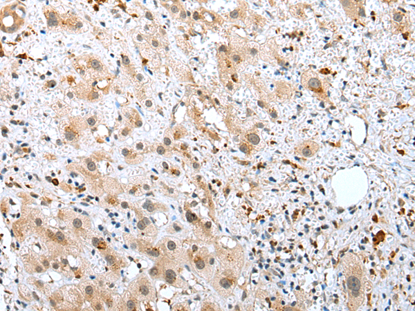 Rabbit Polyclonal Antibody to RHOV