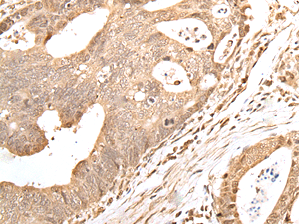 Rabbit Polyclonal Antibody to GRAP