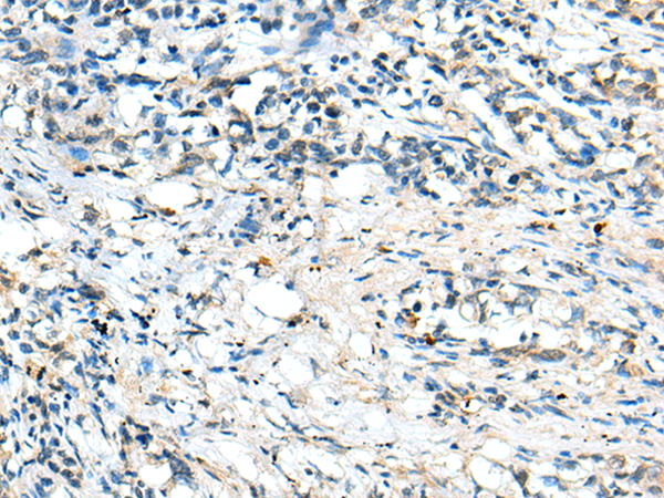 Rabbit Polyclonal Antibody to CFB
