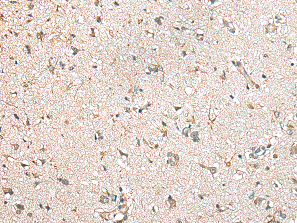 Rabbit Polyclonal Antibody to MIOX