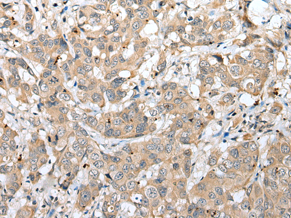 Rabbit Polyclonal Antibody to CAPS2