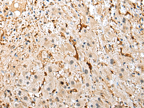 Rabbit Polyclonal Antibody to NPL
