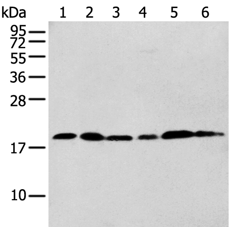 Rabbit Polyclonal Antibody to CNPY2