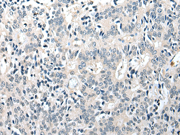 Rabbit Polyclonal Antibody to GMFB