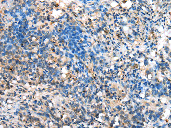 Rabbit Polyclonal Antibody to DHRSX